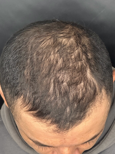 Después - Reflejo de Confianza