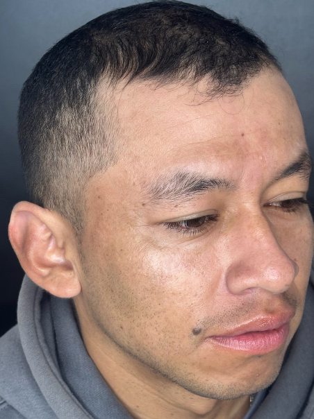 Después - Cabello Definido