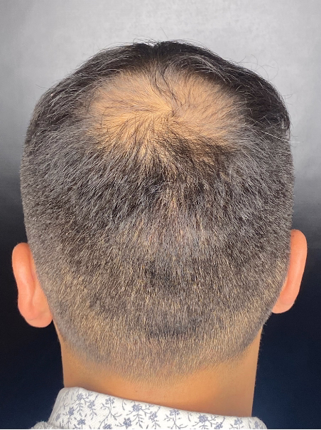 Antes - Cabello Exclusivo