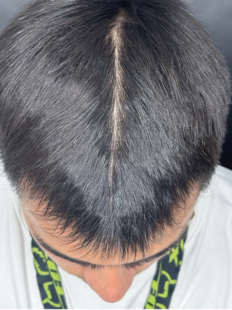 Después - Cabello Más Grueso