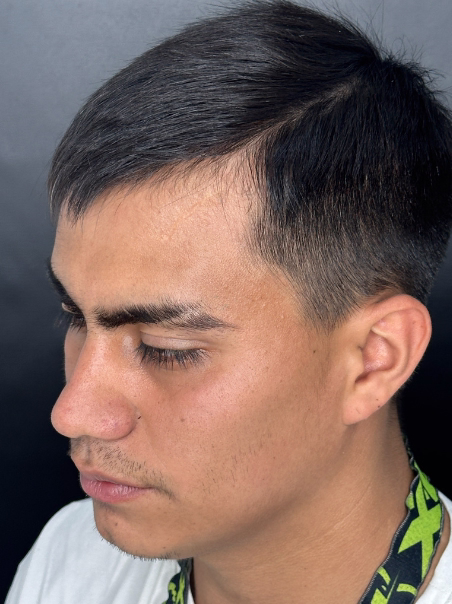 Después - Restauración Capilar