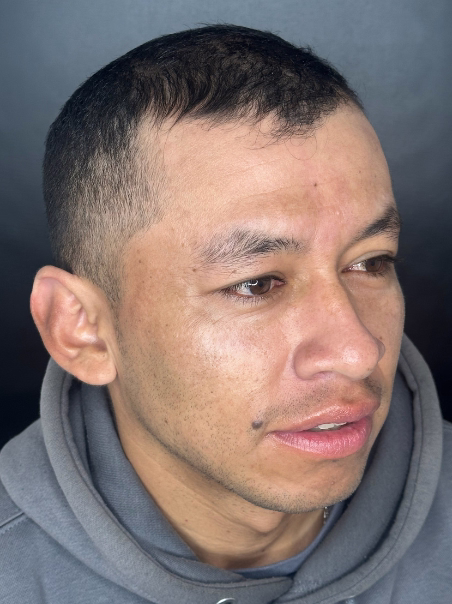 Después - Cabello Saludable