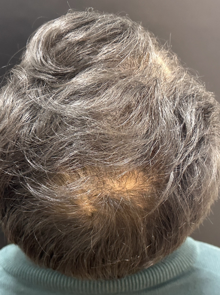 Después - Transformación Total