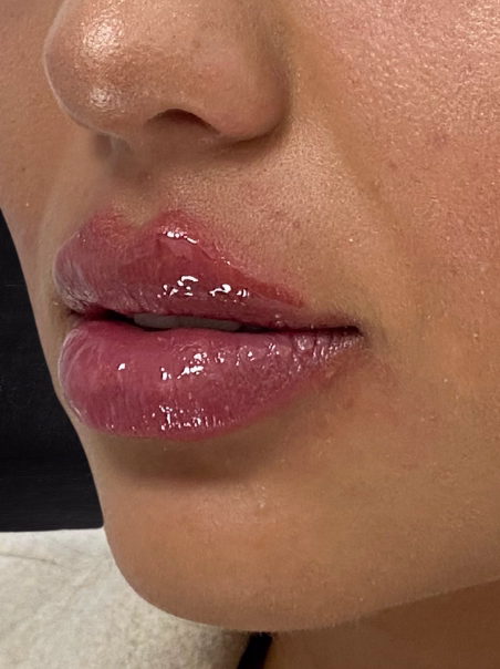 After - Lip Border Definition