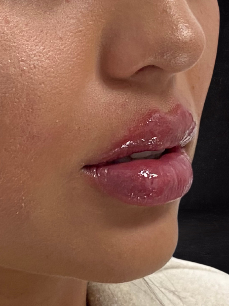 After - Natural Volume