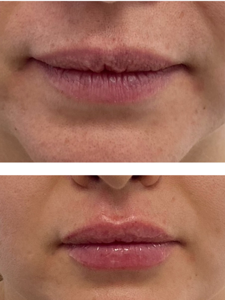 After - Sensual Lips