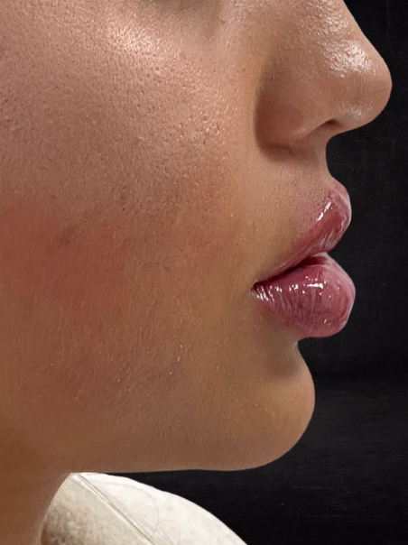 After - Deep Hydration