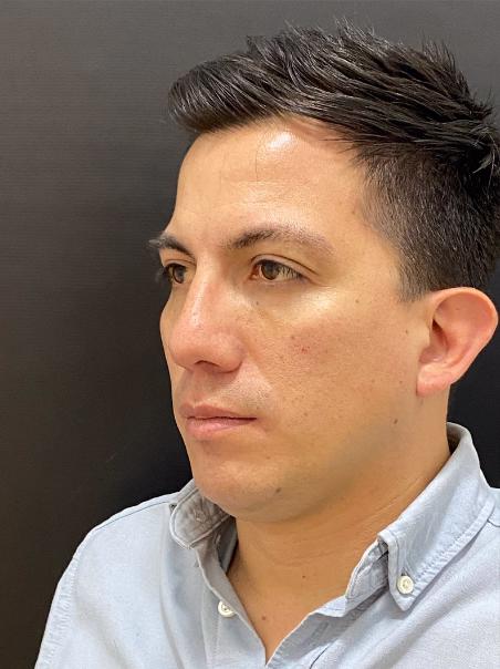 Después - Mirada Cansada