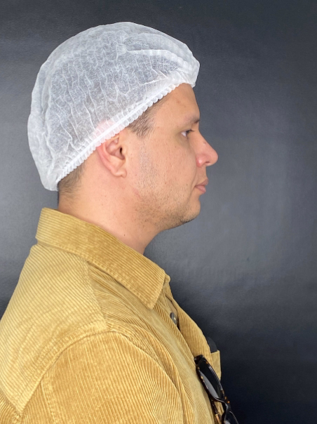 Before - Facial Contouring