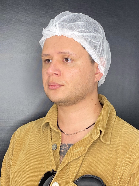 Before - Skin Tightening