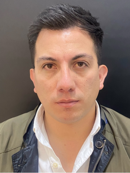 Antes - Ojeras Hundidas