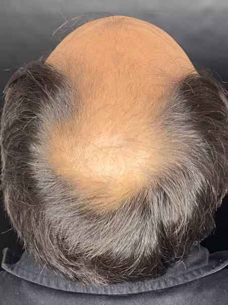 Before Intensive Hair Therapy