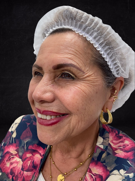 Before - Wrinkle Removal