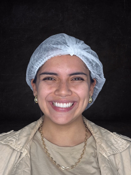 Before - Rested Appearance