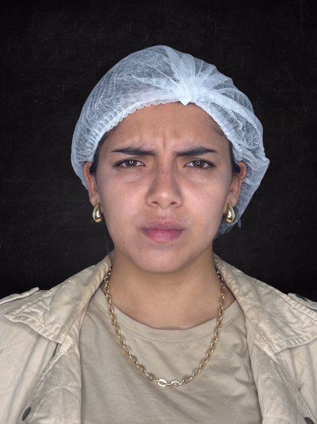 Before - Softened Glabella