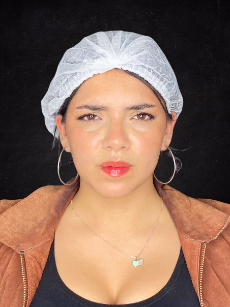 After - Softened Glabella