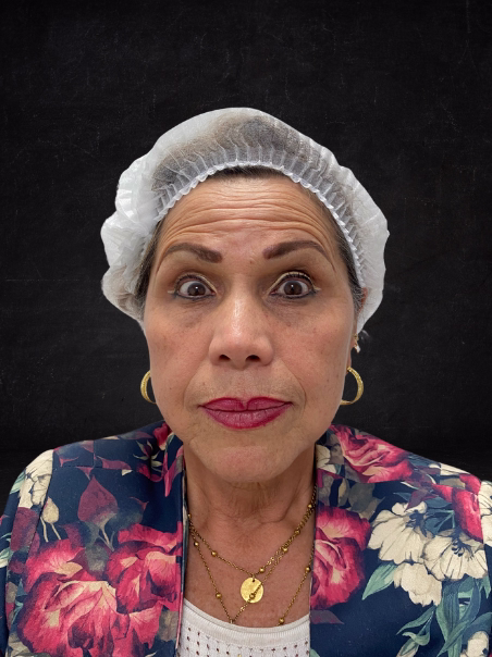 Before - Expression Lines