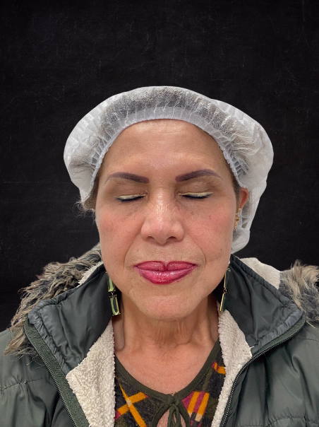 After - Refreshed Gaze