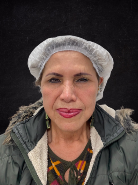 After - Facial Rejuvenation