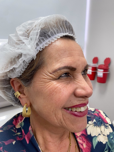 Before - Smoother Skin