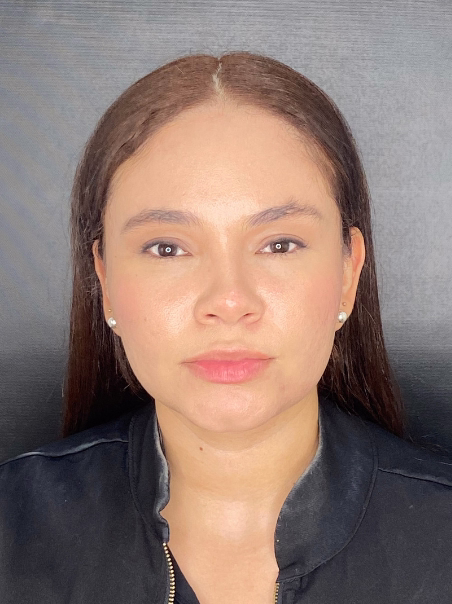 After - Non-Surgical Brow Lift