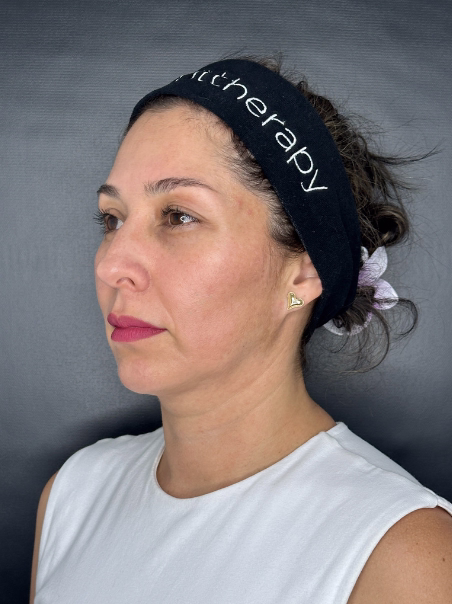 After - Neck Tightening